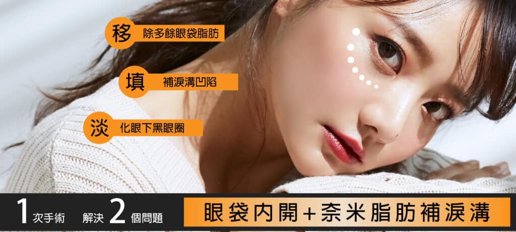 眼袋內開+FG淚溝