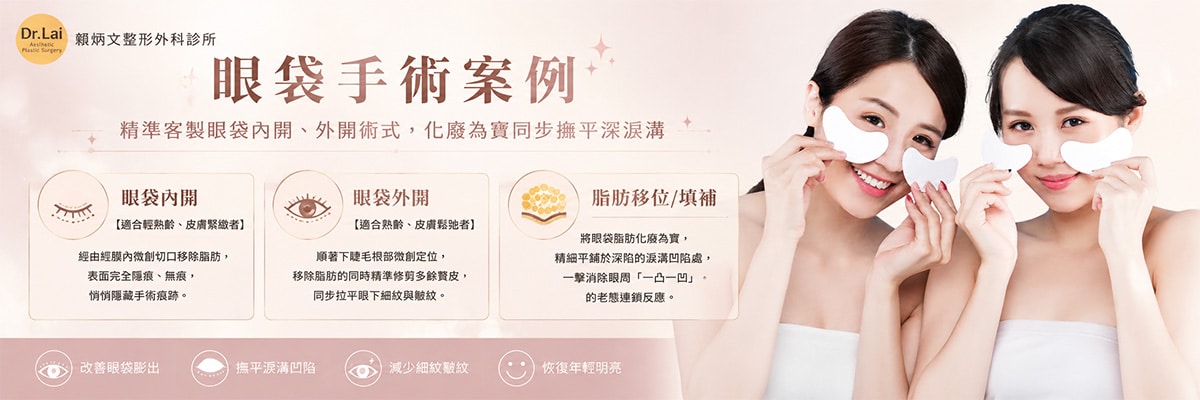 眼袋手術案例