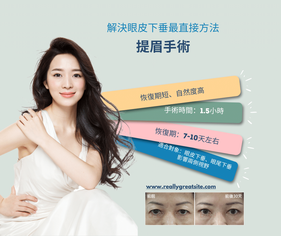 提眉手術示意圖