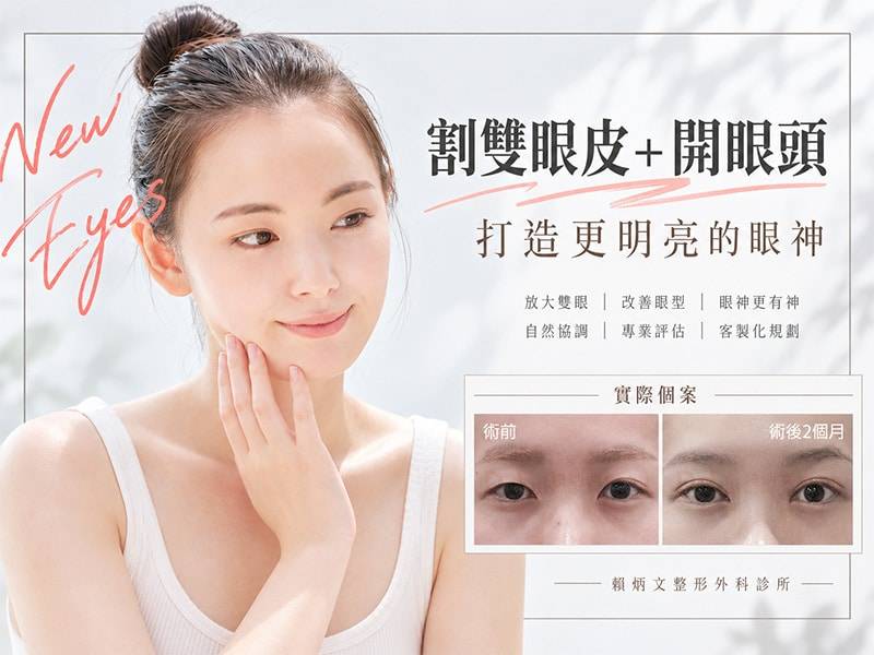 雙眼皮手術